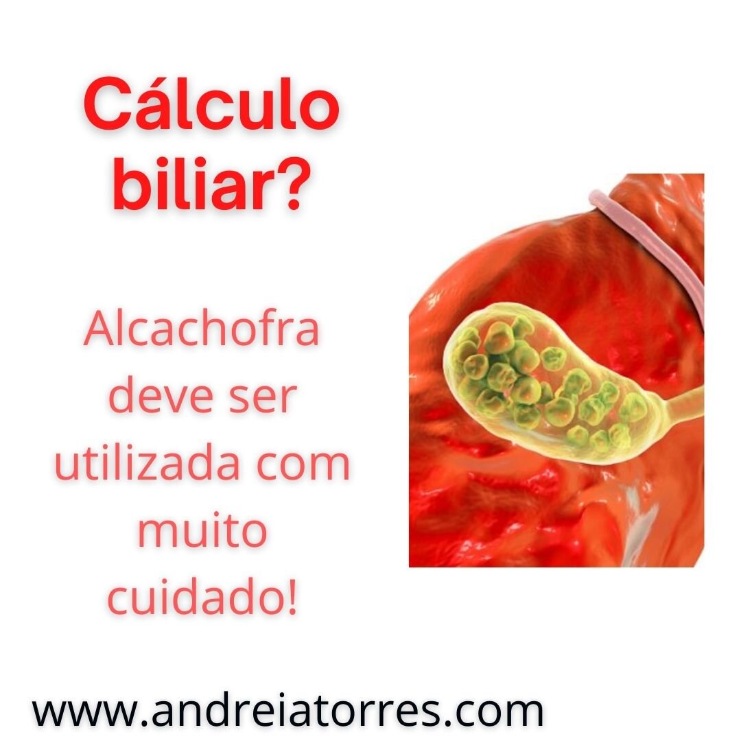 Cálculo biliar | litíase biliar (pedras na vesícula): dieta antes e após a  retirada da vesícula — ANDREIA TORRES - cardápio da dieta após a retirada da vesícula