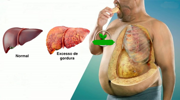 Dieta para gordura no fígado - Cardápio e Chás. O que pode e não pode comer? - cardápio de dieta para gordura no fígado pdf