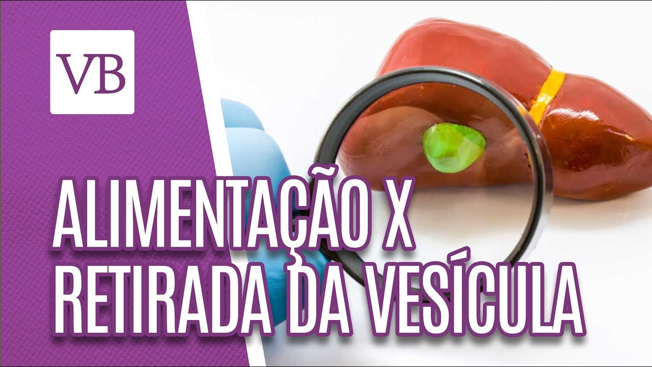 Alimentação x Retirada da vesícula - Você Bonita (17/09/18) - YouTube - cardápio da dieta após a retirada da vesícula